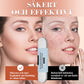 ✨"Medicinsk cellklämma - 100% säkert att ta bort pormaskar från porerna! 🩺🌱"✨