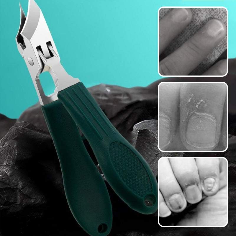 💅❄️ "SLUT PÅ NAGELKATASTROFER! ✂️🛡️ Anti-slack 3-delars set med ergonomiskt grepp – Designad för svenska vinterfingrar" 🌨️🧤
