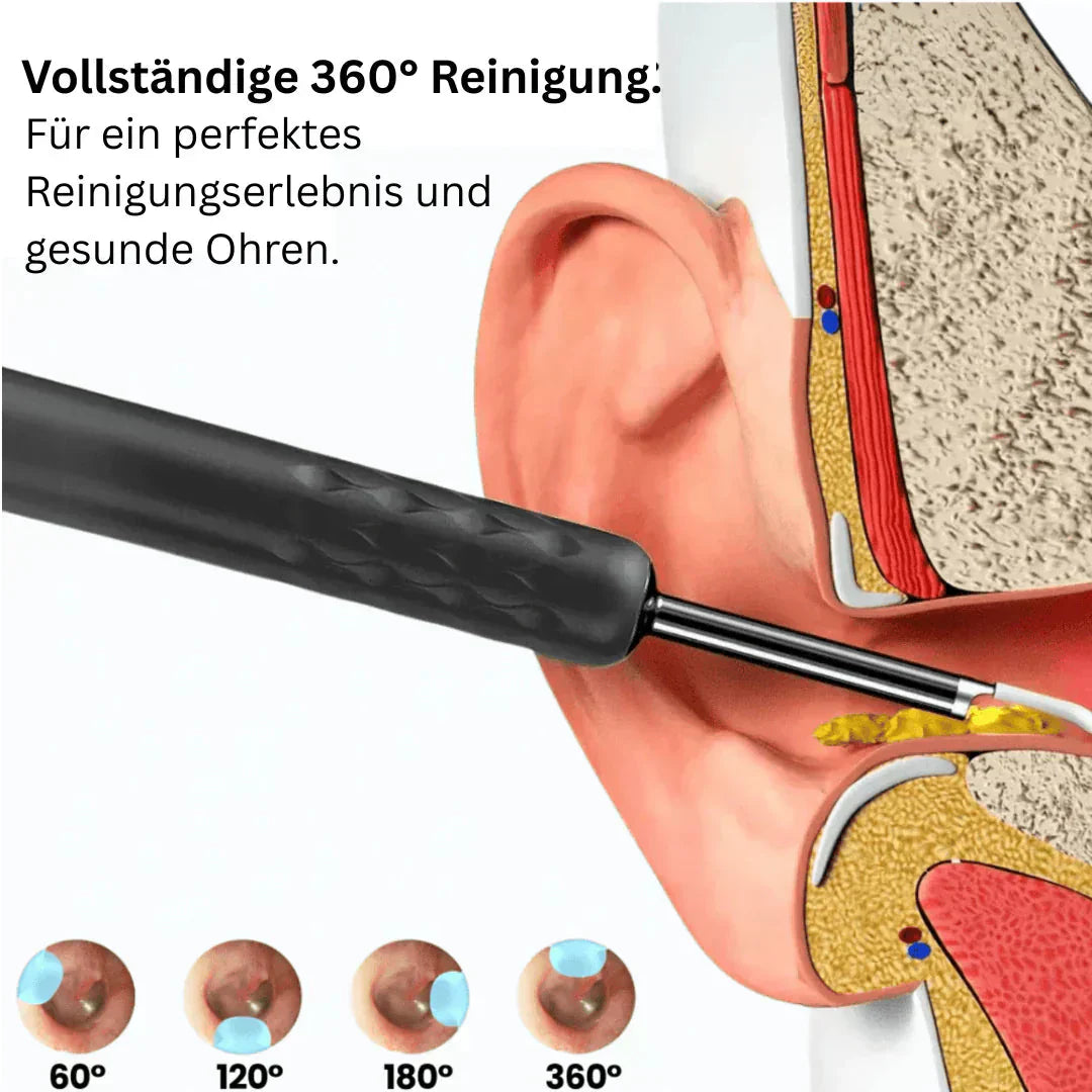 💥2025 års het rea👂Smart vattentätvisuellöronvaxborttagare (begränsad upplaga)